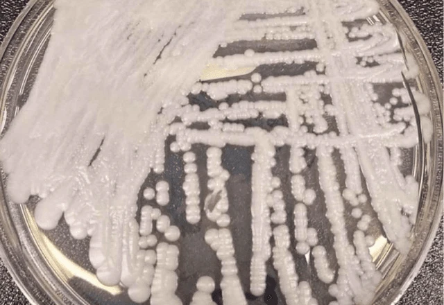 Confirmado caso de superfungo 'Candida auris' no Rio Grande do Norte