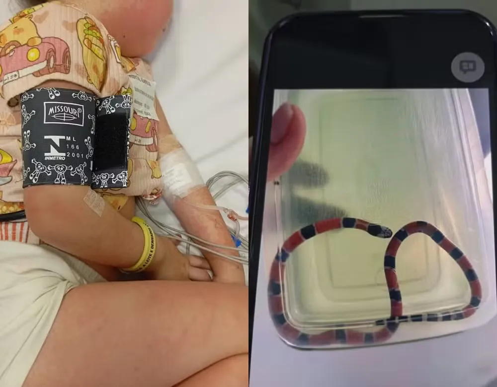 Menina de 4 anos sobrevive a choques anafiláticos após picada de cobra-coral — Foto: Arquivo pessoal