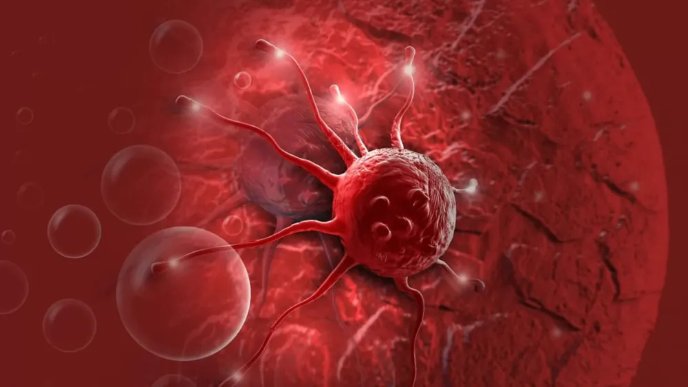 Mortes por câncer devem aumentar em 90% até 2050, diz estudo